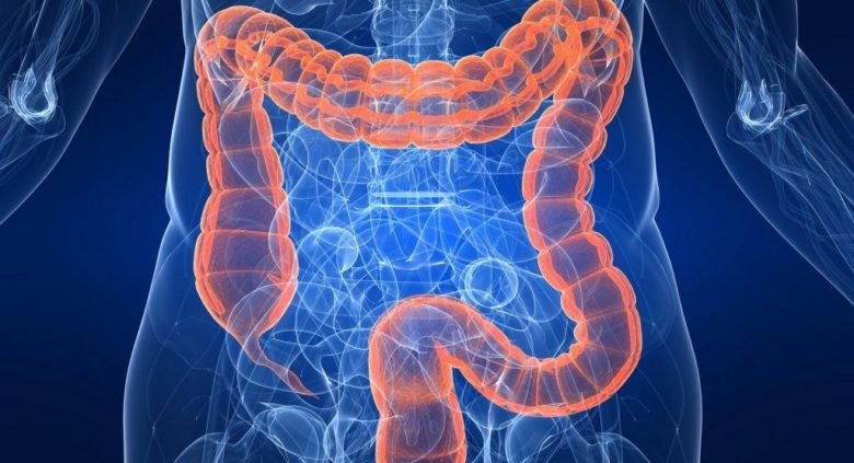 Colon irritabile